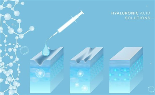 韩国juvelook水光注射的价格揭秘：怎样选择性价比高的美容方案，省钱又有效！