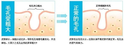 上海热玛吉认证机构有哪些？华美/美莱/时光/伯思立/知颜具备正规认购机构请大家认准医院~