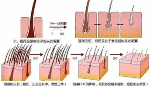 毛囊的不同健康情况