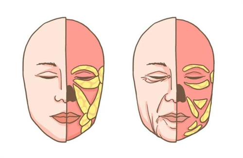 面部衰老卡通图对比