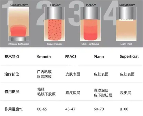 fotona4d欧洲之星技术介绍