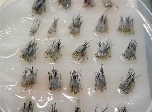 毛囊照片 毛囊照片