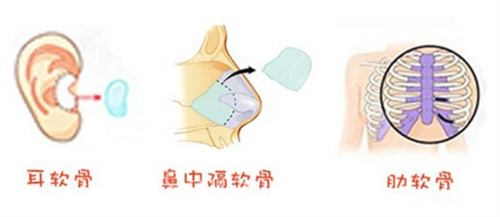 自体组织 自体组织