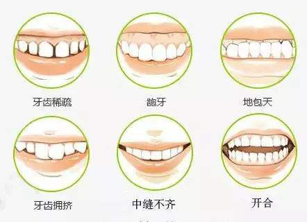 40岁了，牙齿矫正是否还来得及？听听医师怎么说，或许能改变你对牙齿健康的看法！