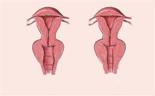 女性阴道松弛和紧致对比