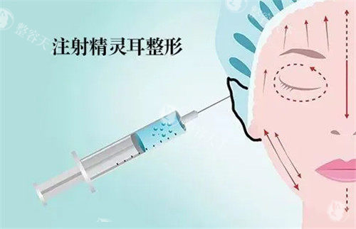 精灵耳注射动画图 精灵耳注射动画图