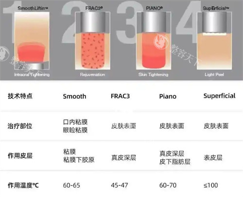 fotona4d欧洲之星技术介绍 fotona4d欧洲之星技术介绍