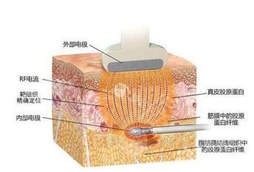 在恩施美年华整形医院进行整形手术的费用和医生简介，帮助您了解整形之路的每一步！