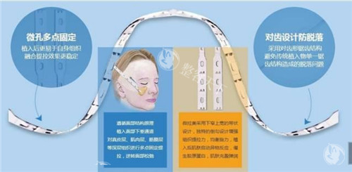 微拉美提升过程图 微拉美提升过程图