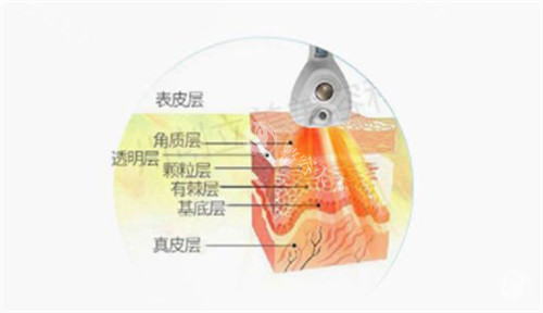 内脂刀仪器可以深入到的层次图解 内脂刀仪器可以深入到的层次图解