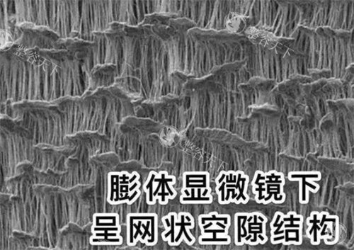 膨体的结构 膨体的结构
