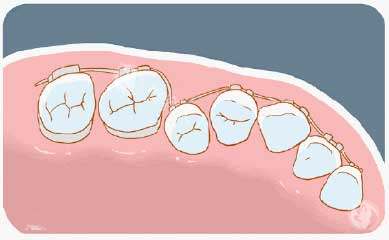 牙齿矫正漫画牙齿图