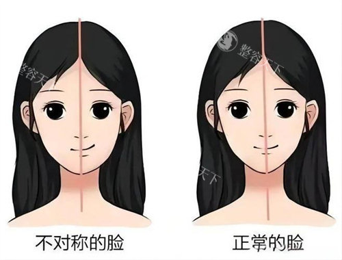 面部不对称与正常的脸对比动画图