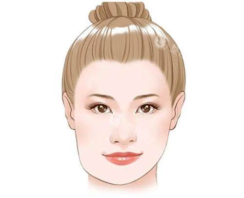 面部不对称的示意图