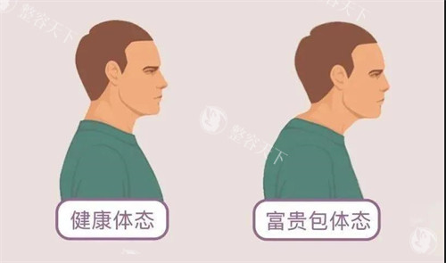 富贵包和健康体态对比动画图 富贵包和健康体态对比动画图