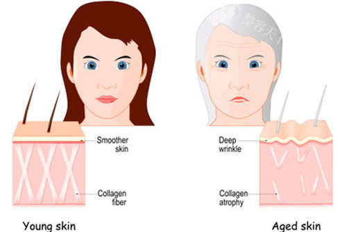 不同年龄段皮肤组织的区别图解