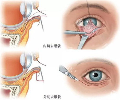 钟杰光医生很靠谱且口碑不差,钟杰光取生长因子及修复馒化脸出名,在广州新市医院坐诊!