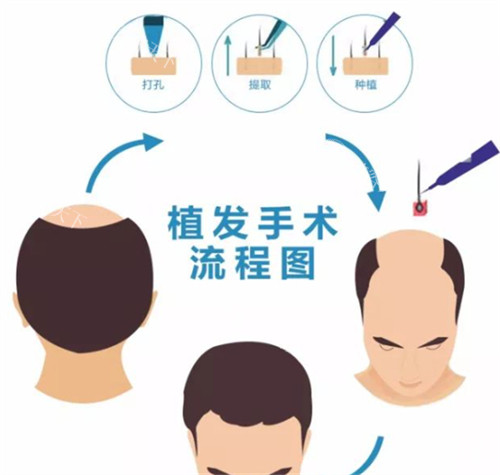 曙光植发国内有几家医院?合肥&广州&烟台&汕头&嘉兴等地均有院区!