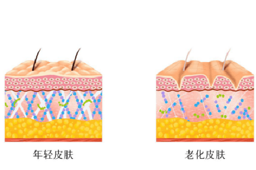 调Q激光主要解决哪些皮肤问题？色素性皮肤、改善肤质、祛除疤痕等！