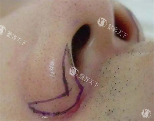 长春中妍医学美容医院如何预约？附上中妍详细预约方式给大家！