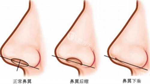 长春中妍医学美容医院如何预约？附上中妍详细预约方式给大家！