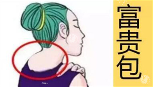 西安富贵包手术哪家医院好？颜即铂澜医疗美容/美合医疗美容/薇莱美医疗美容都很靠谱！