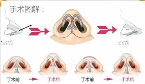 长春中妍医学美容医院如何预约？附上中妍详细预约方式给大家！