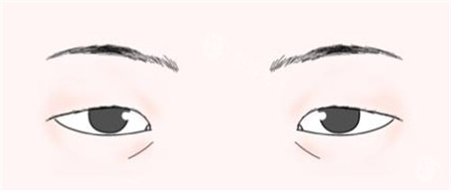 三角眼 三角眼