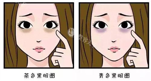 泰奥熊猫针去黑眼圈怎么样？可以填充泪沟和眼袋/淡化黑眼圈不是智商税