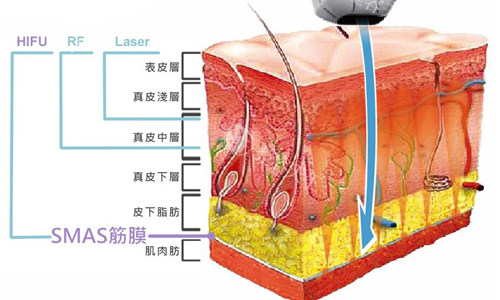 烟台爱丽美整形半岛黄金二代超声炮技术优势|医生|价格等方面深扒，真的越扒越有