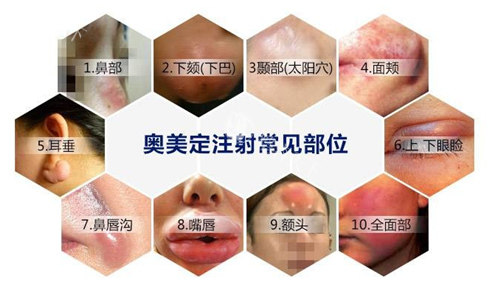 钟杰光医生在哪家医院?口碑怎么样?在广州新市医院坐诊,擅长取生长因子和馒化脸修复!