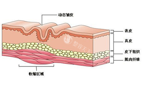7D聚拉提美容的功效和作用揭晓：文内从多个角度详细介绍这一技术！