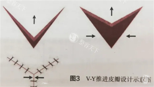 库尔勒做医美的医院哪家好？翟玲玲医疗美容|库尔勒天姿医美|库尔勒奥蕊斯医疗美容三家做医美比较好！