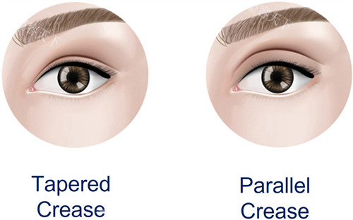 东莞爱思特医疗美容好不好?口碑评价说话,附预约挂号教程