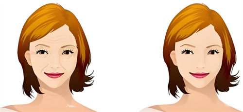 做完热玛吉脸会凹陷吗？深度解析塌脸原因+真实实例与避坑指南分享