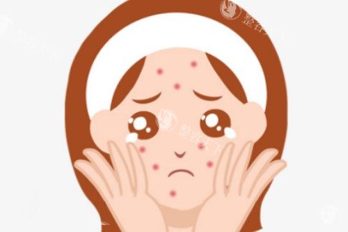 LDM水滴提升和光子嫩肤的区别：从原理、适用范围、治疗过程和结果介绍下！