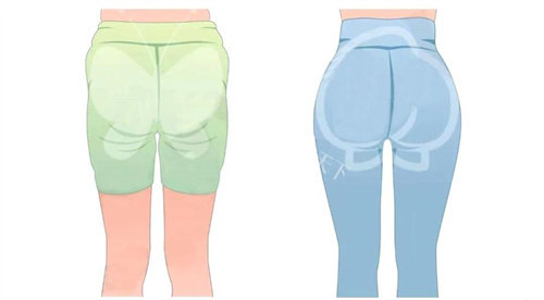 臀部吸脂手术背面对比动画图 臀部吸脂手术背面对比动画图