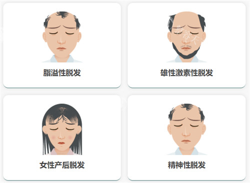 南昌佳美美容医院植发科怎么样？做植发他们家的口碑和评价是非常好的！