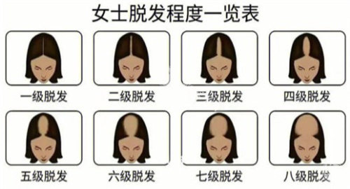 柯维好医生植发多少钱?6-20元起/毛囊单位，看看顾客口碑怎么样吧!