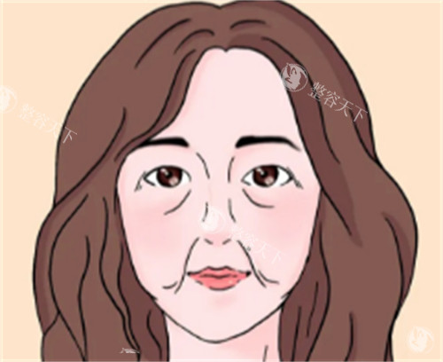 菲羽玻尿酸多少钱一支？2025更新价格表+结果能维持多久？医生揭秘避坑指南