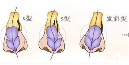 唇腭裂修复手术大概需要多少费用？2025年价格详解（含北京/上海/广州报价）