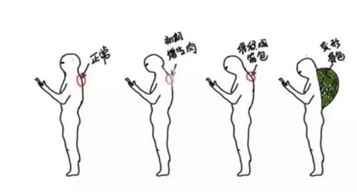长沙艺脂医疗美容医院吸脂富贵包结果怎么样？不仅技术好且性价比较高！