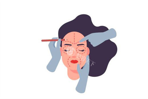 整形设计划线图 整形设计划线图