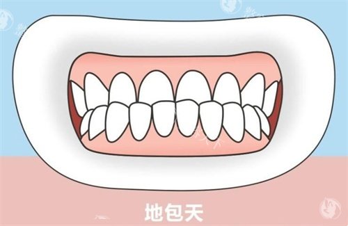 骨性地包天必须手术吗？建议结合患者年龄+畸形程度+功能需求综合评估更靠谱！