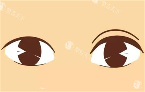 西安美莱医学美容医院收费价目表已公开！双眼皮4800+隆鼻7740+隆胸16800+