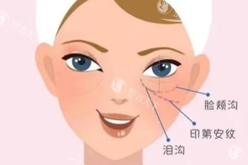 热拉提有哪些作用和功效？紧致肌肤、减少皱纹、提升面部轮廓等！