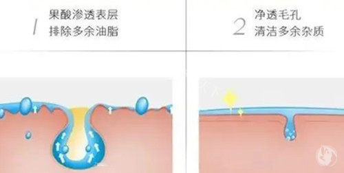 长期投资美丽！揭秘那些值得一试的医美项目及其价格