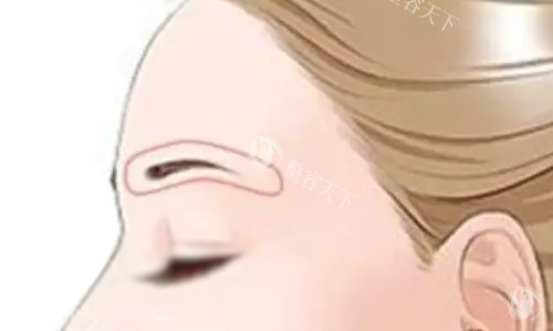 牡丹江哪家整形医院提眉好？君美施医疗美容提眉技术好且价格低+整友术后评价！