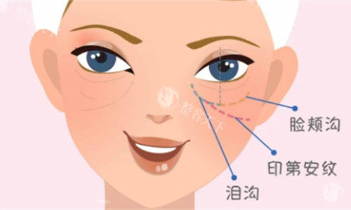 重庆李喆医生筋膜提升价格大公开!眼周1.5万起,面部1.8万起,抗衰性价比高的是它?