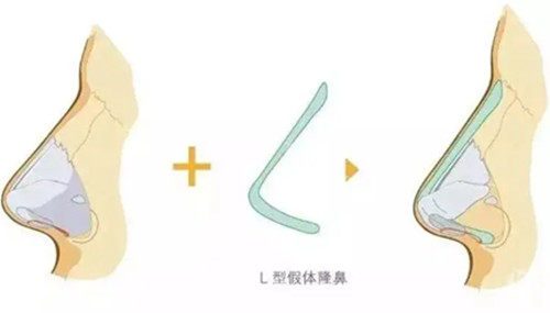 大连成莱医疗美容怎么样？本地人强推的宝藏机构，专注五官整形与抗衰！